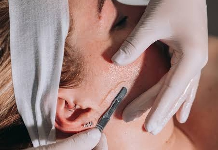 Dermaplaning